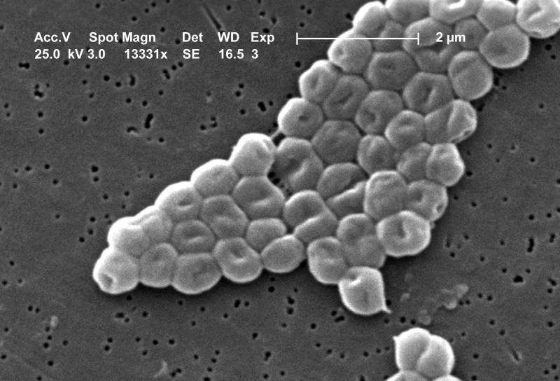 El patógeno Acinetobacter baumannii, resistente a multitud de antibióticos.