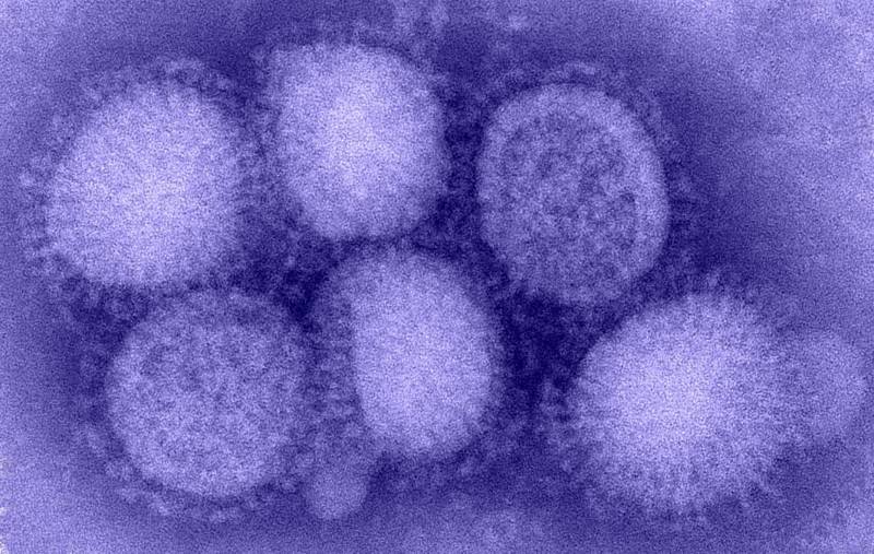 El 76% de las personas que fallecen por gripe A sufren otras enfermedades paralelas