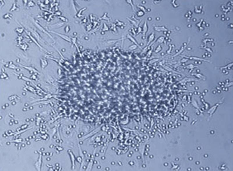 Colonia de células madres estudiadas en esta investigación. Imagen: RECAVA.