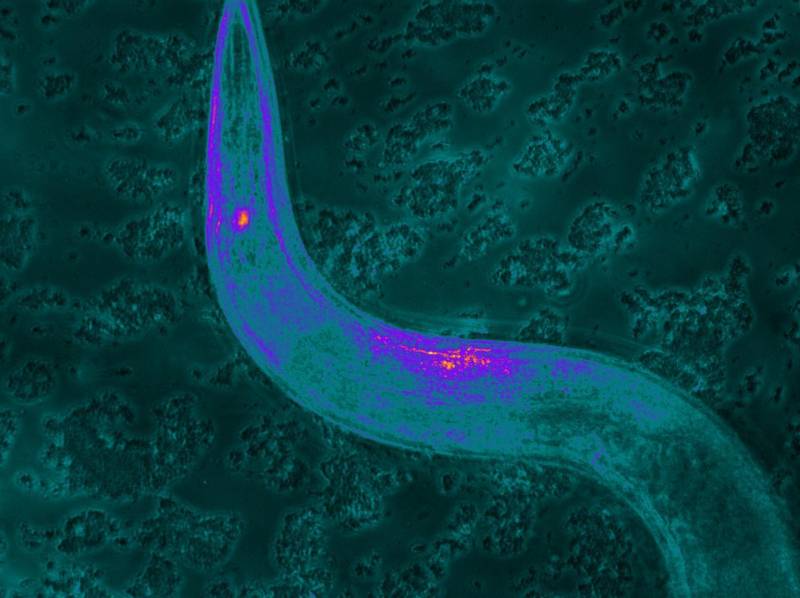 El gusano C. elegans con TMC-1 expresando neuronas quimiosensoriales marcadas con una proteína fluorescente. /William Schafer 