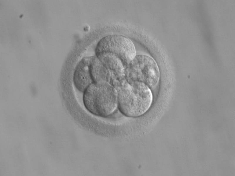 Embrión humano tres días después de la fertilización. Imagen: Wikipedia