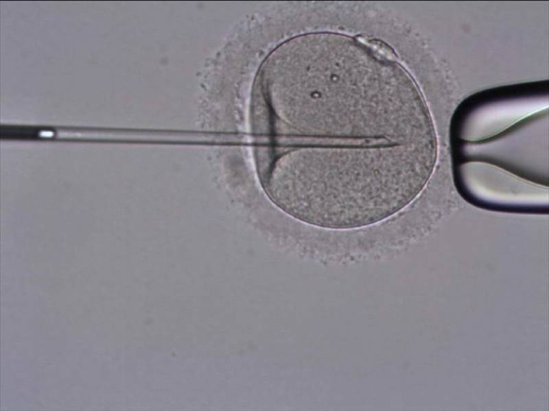 En la fecundación in vitro la fertilización de los ovocitos por los espermatozoides se realiza fuera del cuerpo de la madre. Imagen: Tahe. 