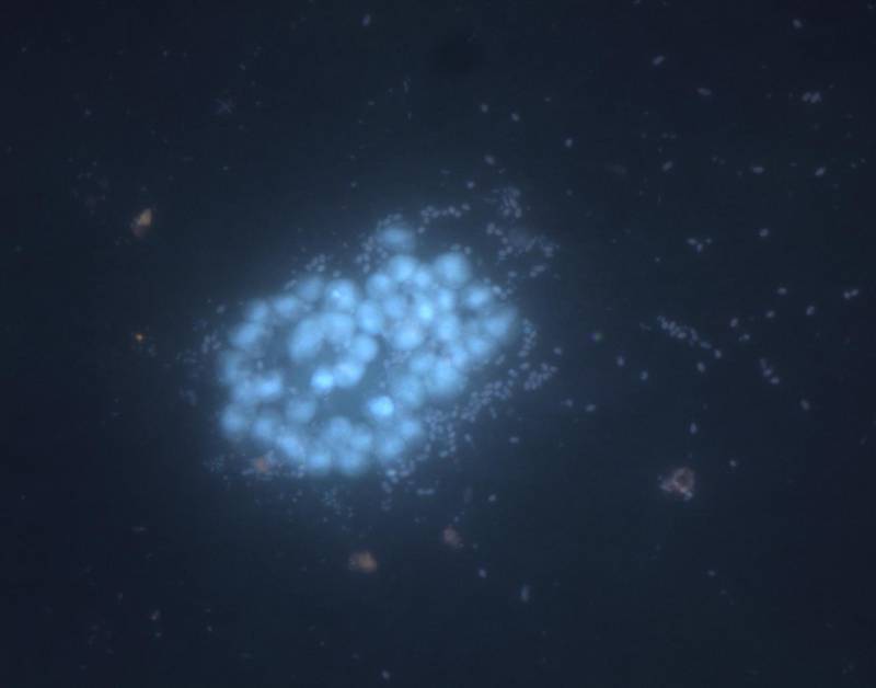 Imagen de microscopio de epifluorescencia conteniendo diferentes morfologías microscópicas no identificadas presentes en las saladas de Monegros. Crédito: A Pena-Baixeras. / CSIC.