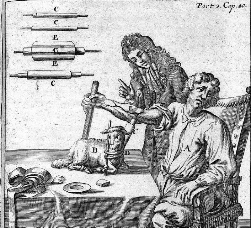 El 15 de junio de 1667 Jean-Baptiste Denys realiza la primera transfusión de sangre de la historia