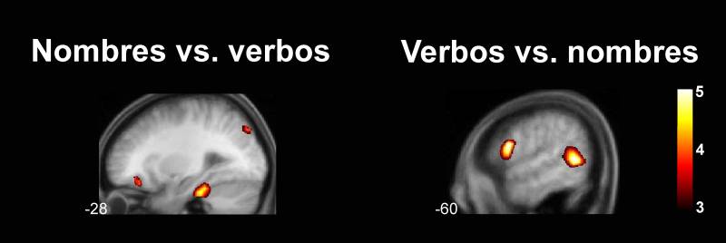 Los nombres y los verbos se aprenden en regiones diferentes del cerebro