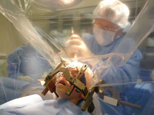 Cirugía pediátrica de un dispositivo de estimulación cerebral profunda. Wikipedia