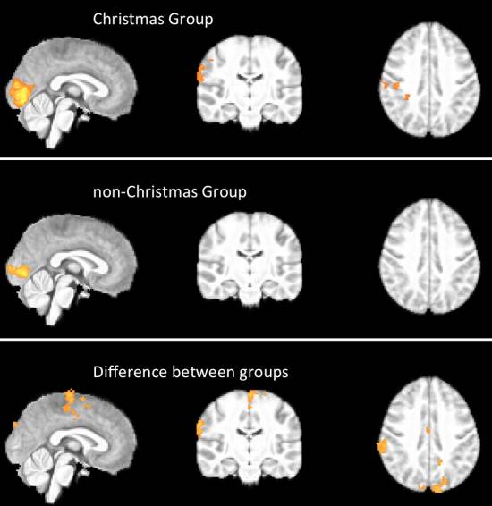 Activación cerebral en los distintos grupos./ BMJ Publishing Group Ltd