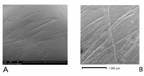 Imágenes de las marcas analizadas: A. Un incisivo de Homo antecessor (Gran Dolina-Atapuerca) y B. un incisivo de preneandertal de la Sima de los Huesos (Atapuerca) - IPHES