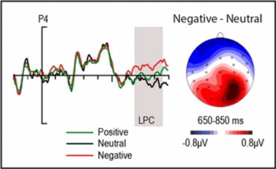 Patrón de actividad eléctrica cerebral característica del procesamiento de estimulos emocionales (EPN) producida por palabras negativas subliminales en comparación con palabras neutras / UCM-ISCIII