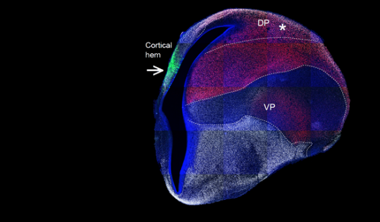Las neuronas que nacen en el cortical hem, teñidas con la proteína fluorescente verde GFP, no migran hacia el palio dorsal (DP, marcado con un asterisco), la región homóloga a la neocorteza de mamíferos / © Fernando García-Moreno