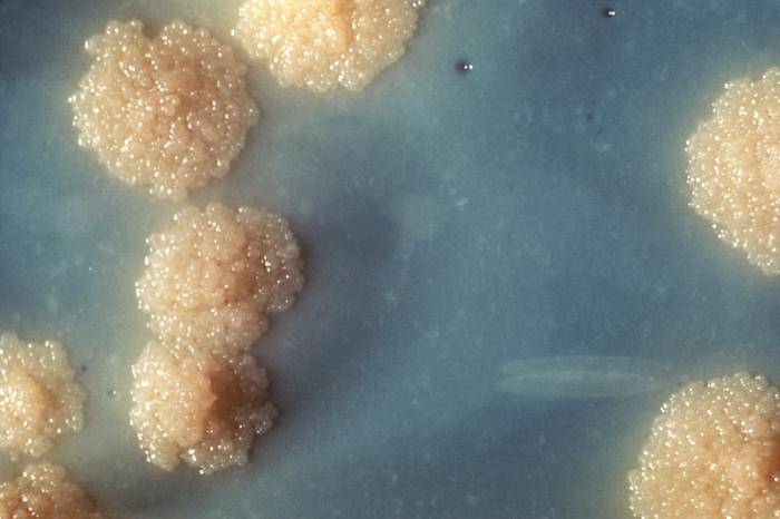 Colonias de Mycobacterium tuberculosis sobre un medio de cultivo. Foto: George Kubica.
