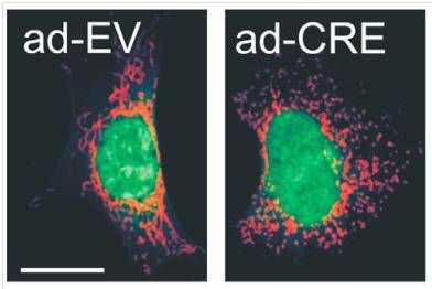 La imagen refleja el cambio en la forma de las mitocondrias de fibroblastos de ratón