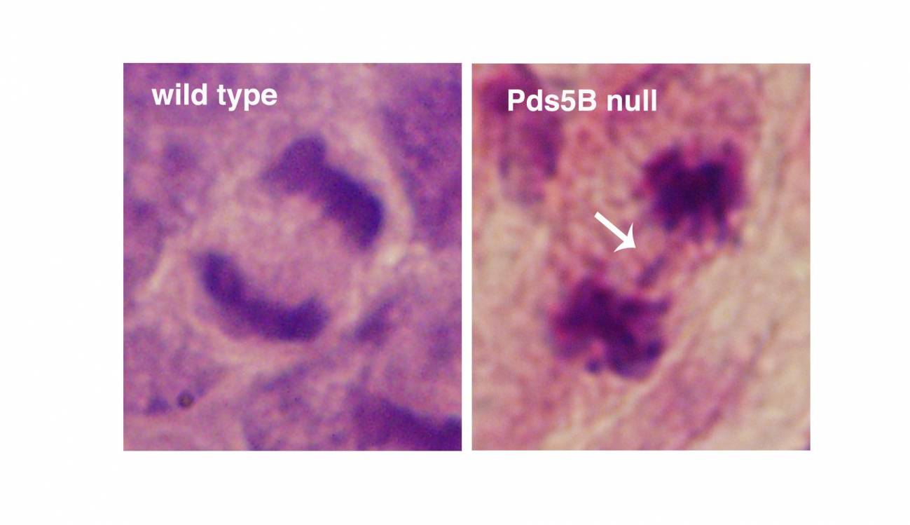 células que carecen de Pds5B y células normales