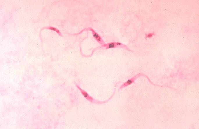El llamado Mal de Chagas es una enfermedad infecciosa causada por 'Trypanosoma cruzi'