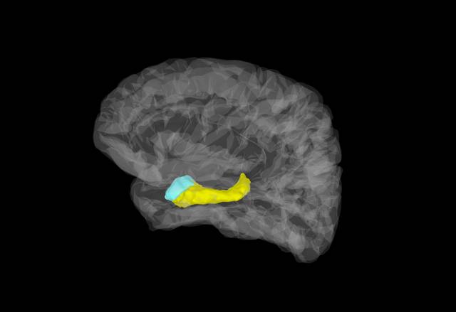 Imagen cerebral en la que aparecen coloreadas la amígdala (azul) y el hipocampo (amarillo). / Stephan Moratti.