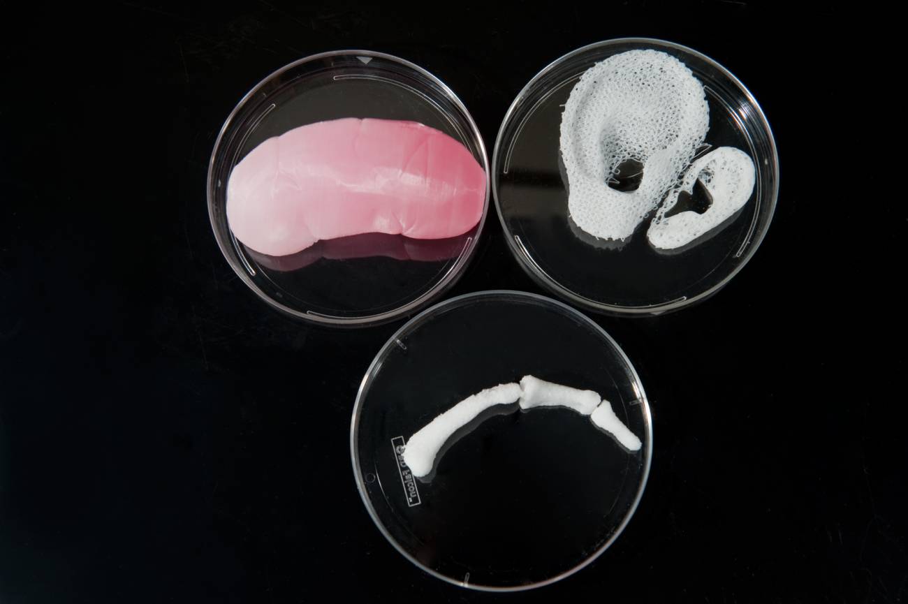 Un riñón, un dedo y una oreja imprimidos en 3D