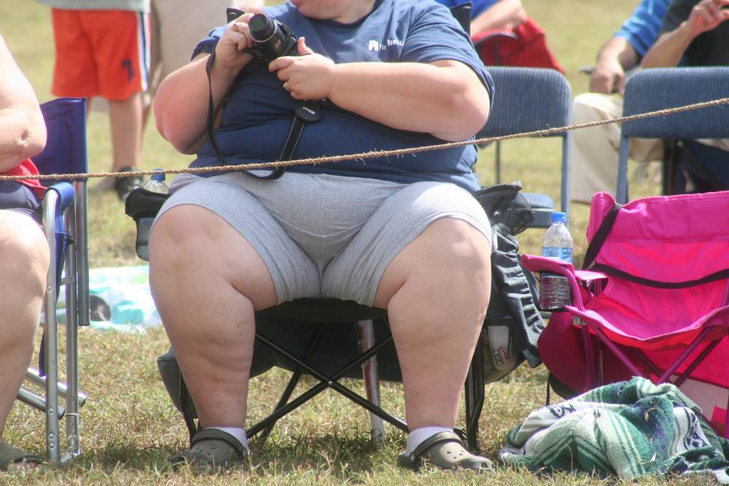Hombre con obesidad