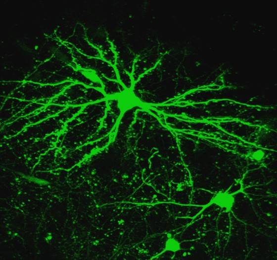 Neuronas y espinas dendríticas