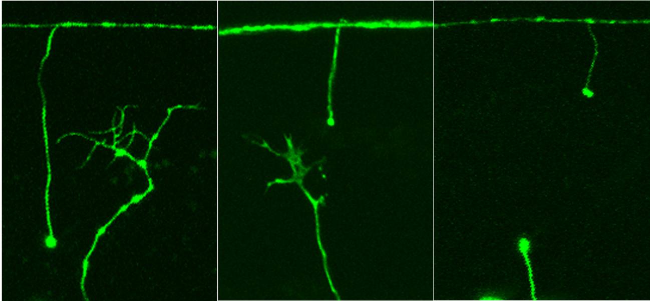Descubren una nueva vía para regenerar nervios lesionados a partir de un gen de gusano