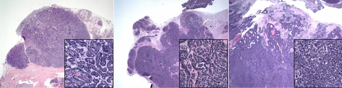 Tumores en la glándula mamaria de ratones.