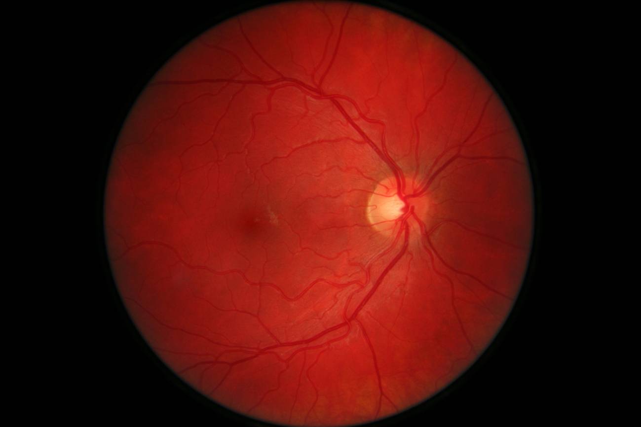La retina, un puzzle de más de un millón de piezas