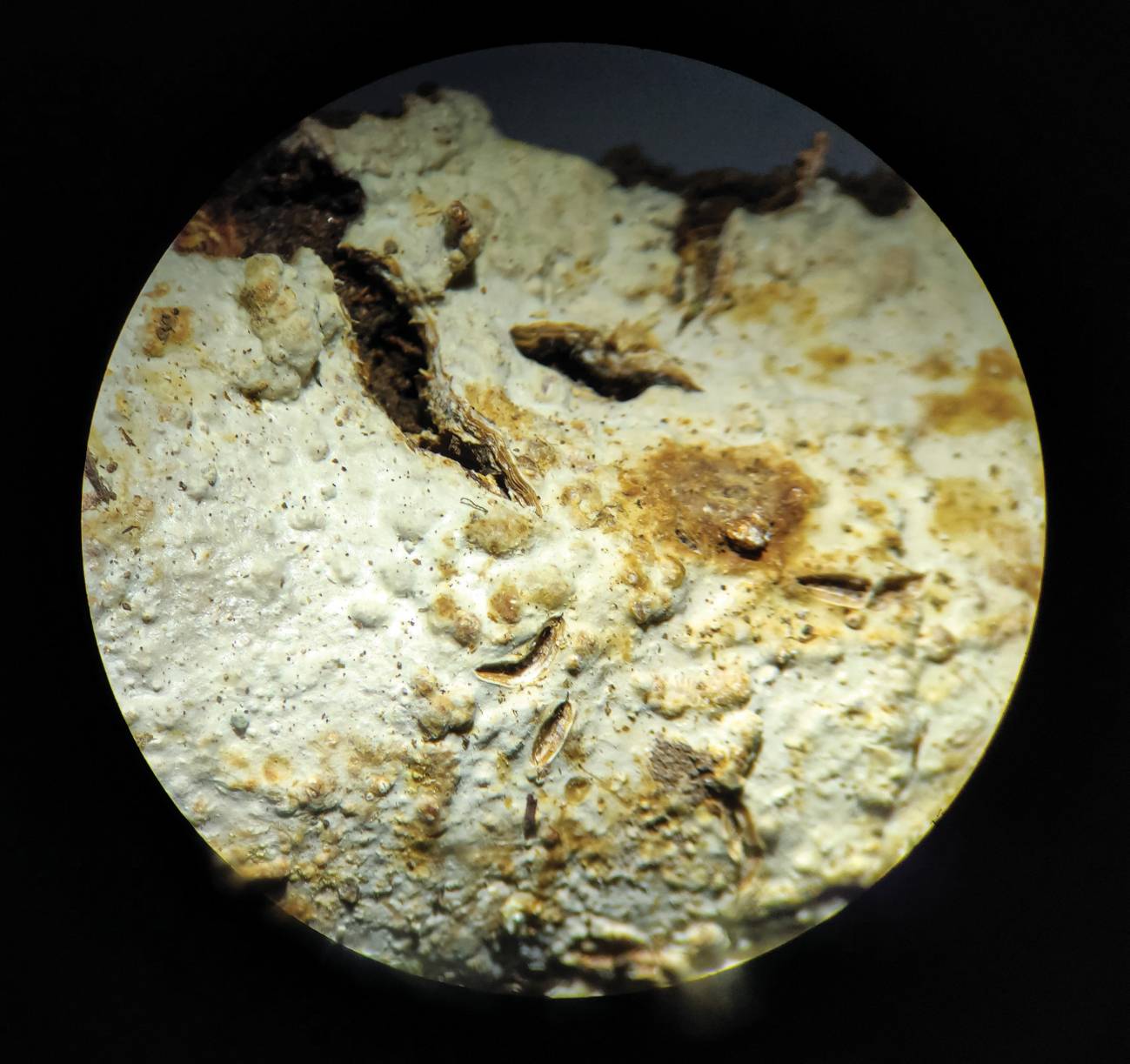 Gloeocystidiellum lojanense vista desde el microscopio