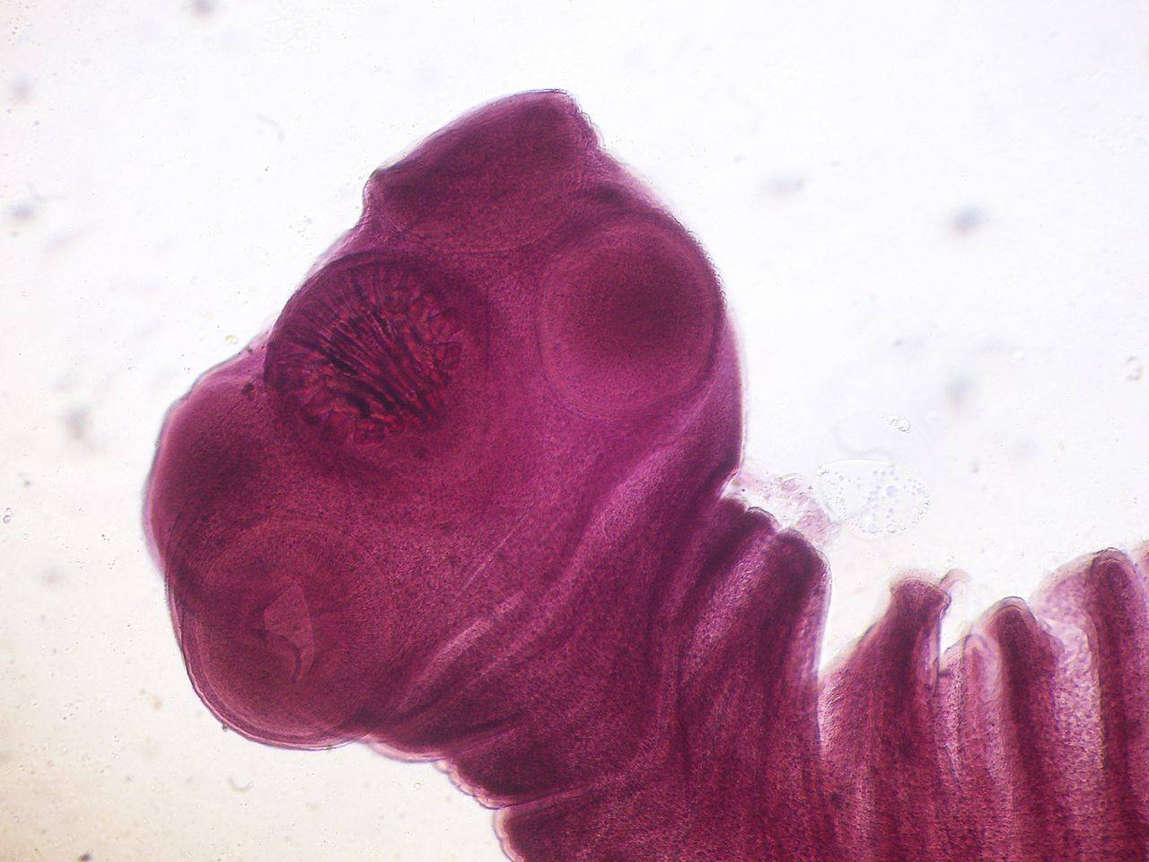 etapas larvales o intermedias de desarrollo de la tenia porcina