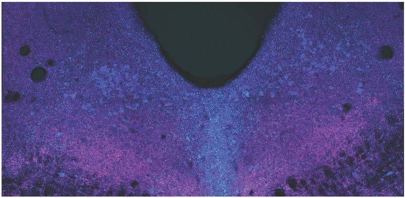 Imágenes de la zona del rafe dorsal del cerebro
