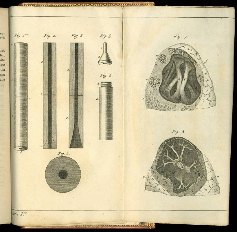 6 Rene Theophile Hyacinthe Laennec 1781 1826 Drawings stethoscope and lungs