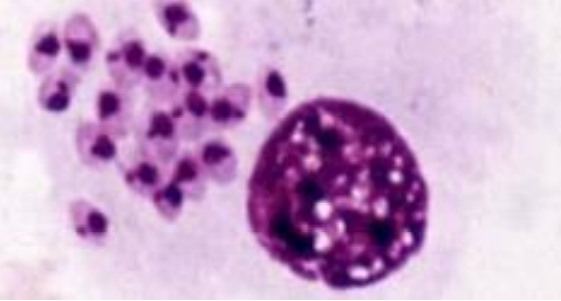 Fase intracelular del parásito Leishmania spp. en las células de la médula ósea de un perro. / CIB