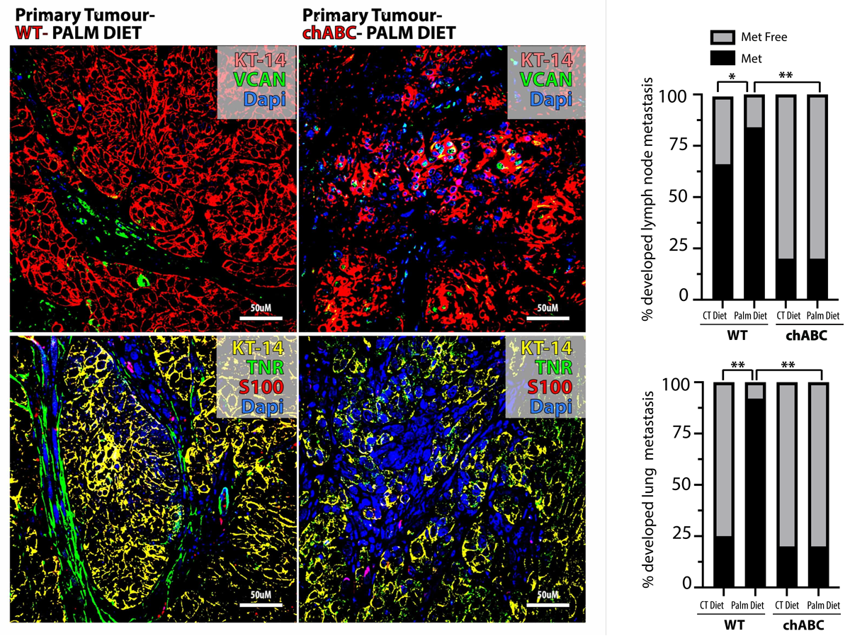 celulas de Schwann asociadas al tumor - Investigadores del IRB Barcelona publican que el  ácido palmítico promueve la metástasis y hace más agresivas a las células tumorales