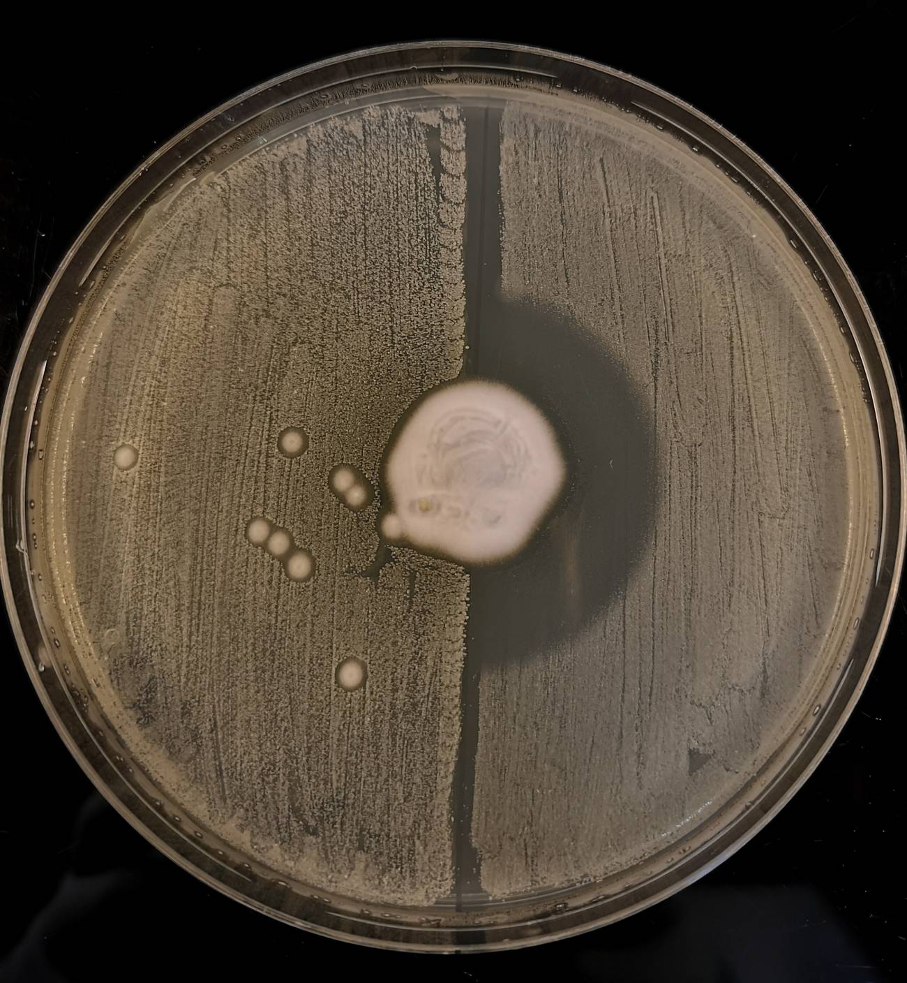Estudio revela que bacteria Staphylococcus aureus  apareció en los erizos, donde también vive hongo parásito que produce antibióticos contra ella de forma natural.