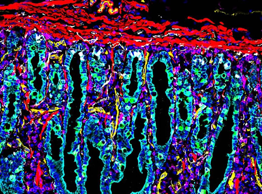 Imagen celular del intestino delgado