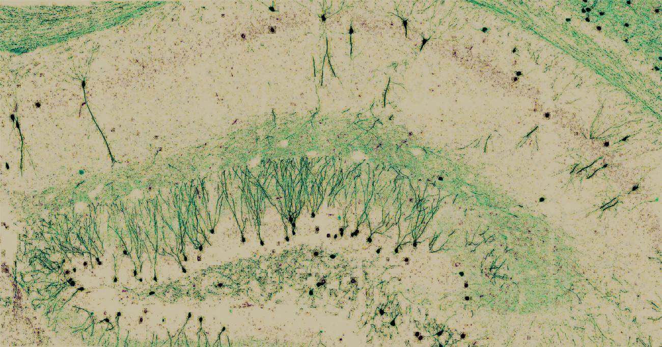 Neuronas teñidas de un ratón activadas durante la formación de un recuerdo.