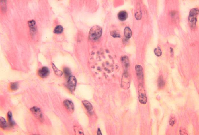 Trypanosoma cruzi en corazón de mono. Histopatología.