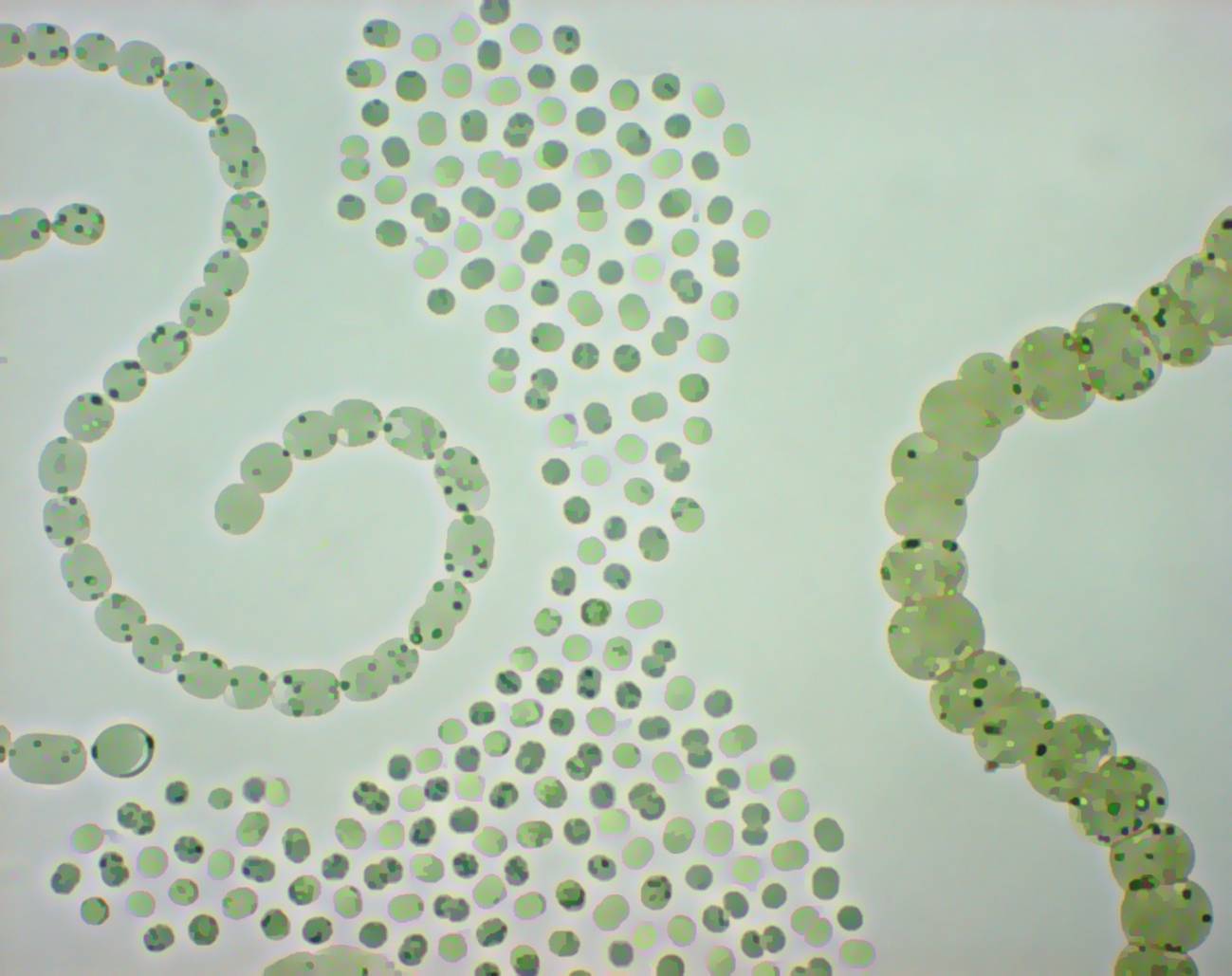Población de cianobacterias (Anabaena spp. y Microcystis aeruginosa). Imagen: Y. Ouahid. 