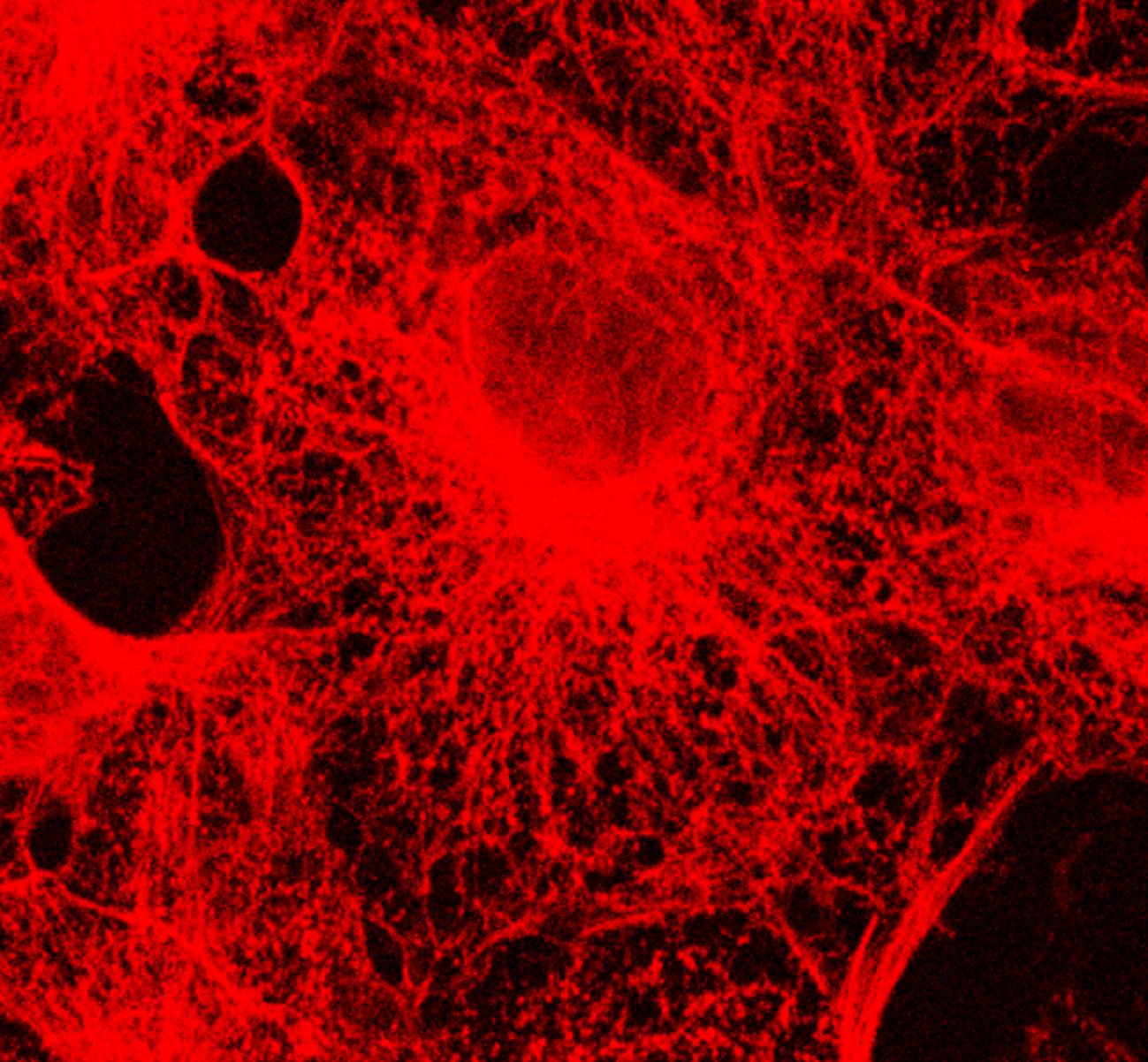 Células en cultivo con su citoesqueleto marcado por moléculas fluorescente