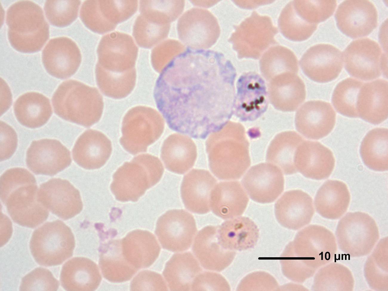 Plasmodium y glóbulos rojos