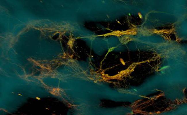 Imagen al microscopio de neuronas (en amarillo verdoso) unidas al armazón base de seda (azul). Las neuronas forman redes funcionales a través de los poros del andamio (áreas oscuras). / Universidad de Tufts