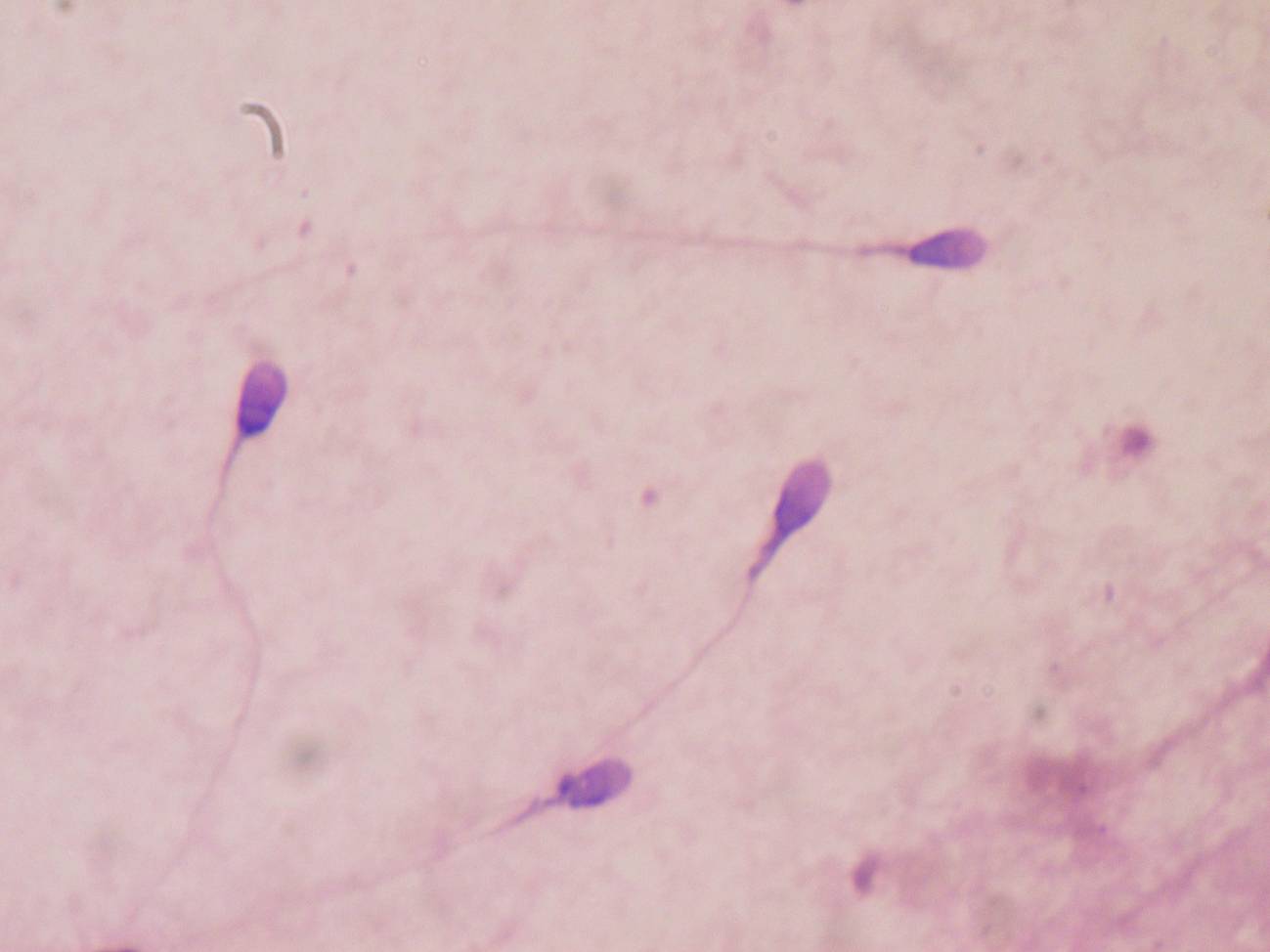 Espermatozoides humanos teñidos para examinar calidad seminal. Imagen: Bob J. Galindo