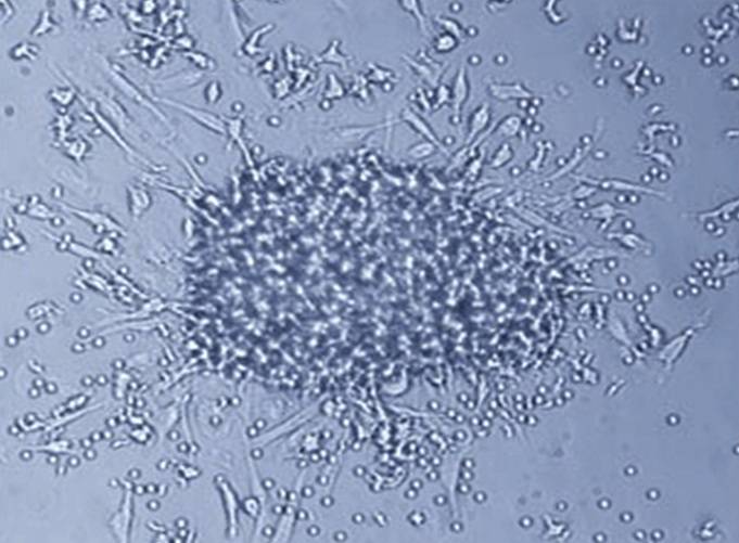 Colonia de células madres estudiadas en esta investigación. Imagen: RECAVA.