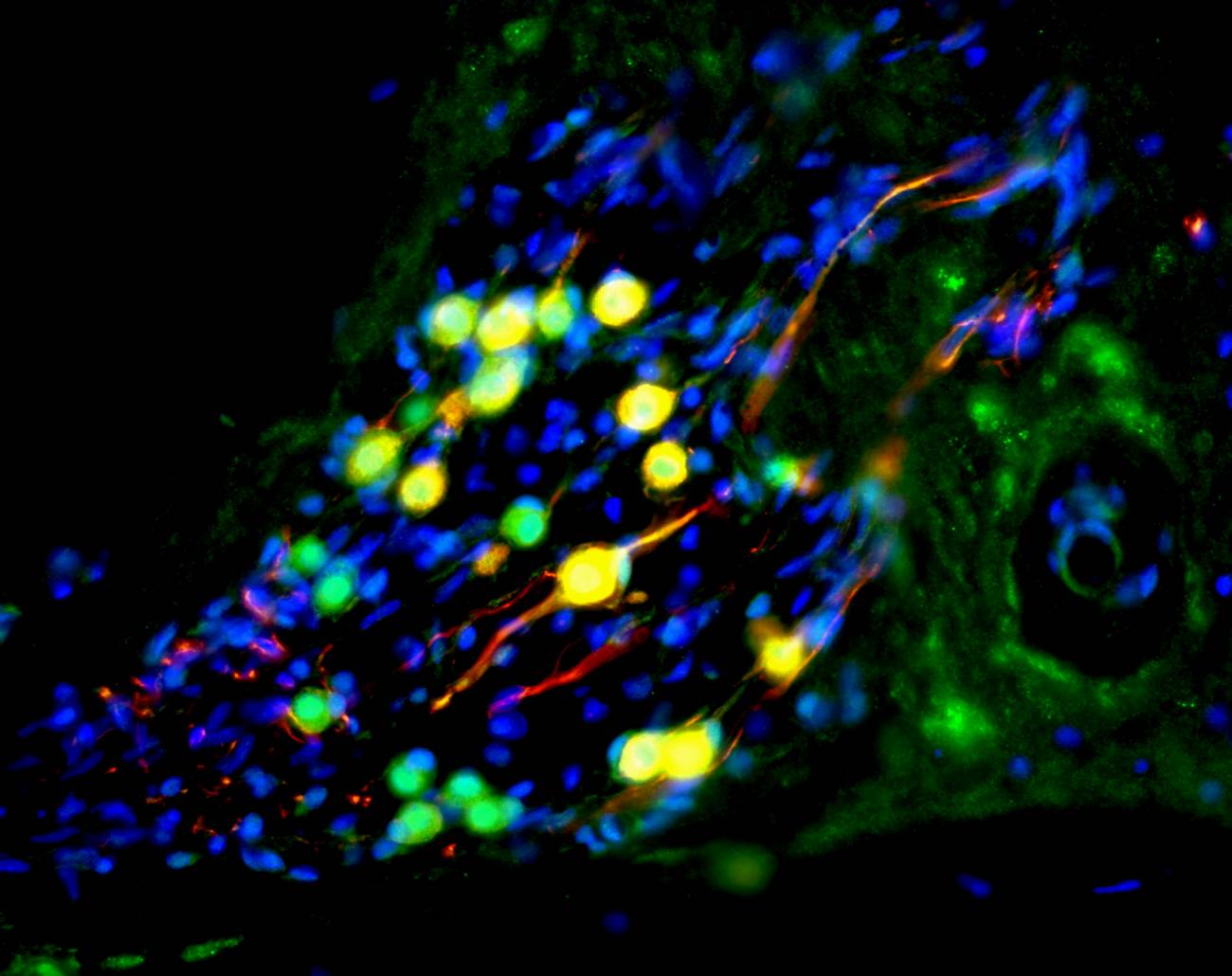 Una neurona auditiva derivada de células madre repuebla la cóclea de un jerbo sordo. Las células humanas son las coloreadas en verde. El color rojo es un marcador de diferenciación neuronal. Imagen: Marcelo Rivolta, Universidad of Sheffield.  