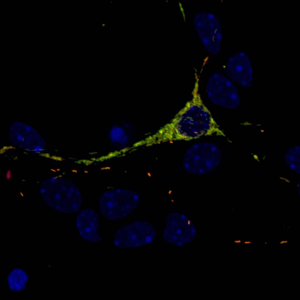 En la foto, una neurona cerebral en cultivo. Imagen: IRB Barcelona. 