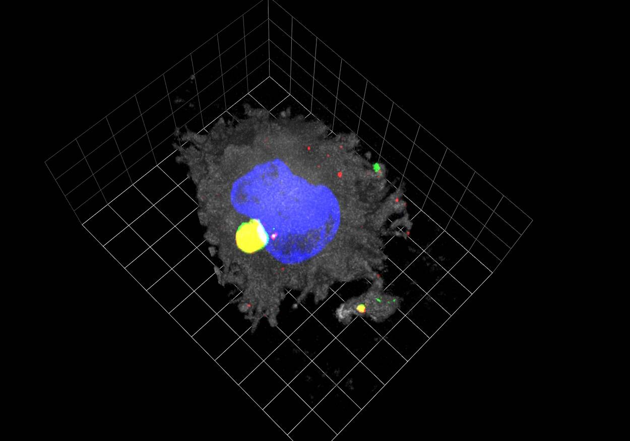 Reconstrucción tridimensional de una célula dendrítica madura (en gris) donde el VIH (en rojo) se almacena con el nuevo receptor identificado, Siglec-1 (en verde). Imagen: IrsiCaixa 
