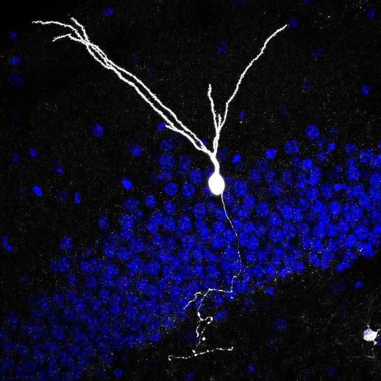 Axón al microscopio. Imagen :Functional Neurogenesis  