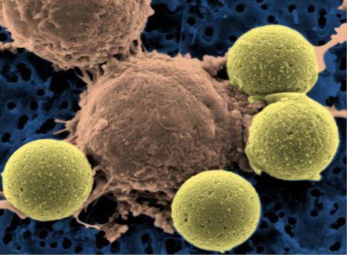 Células T (en el centro). Imagen: Microbe World