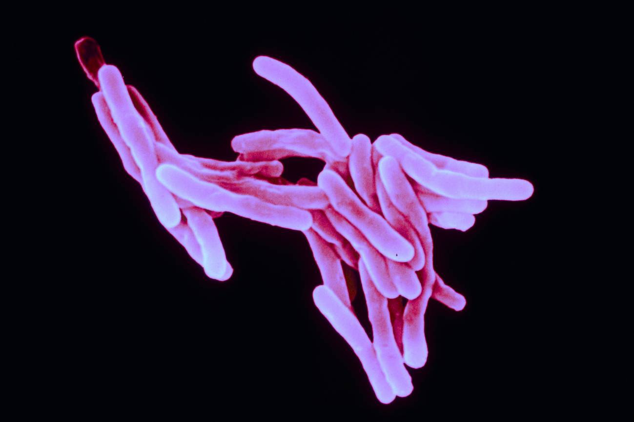 Mycobacterium tuberculosis bacillus