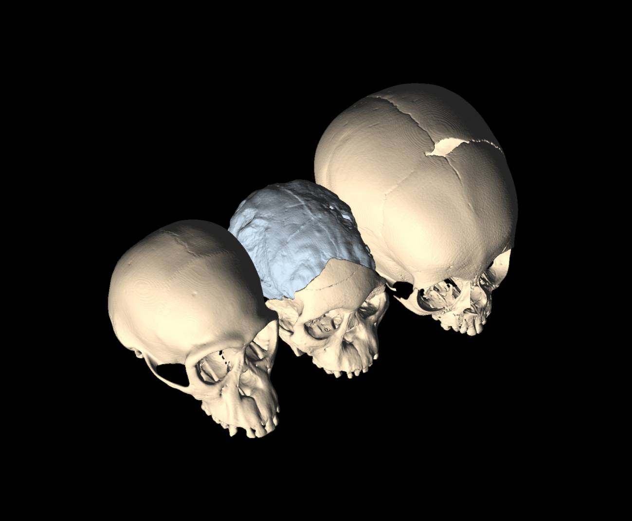 Imágenes del cráneo obtenidas por escáner. Imagen: M. Ponce de León y Ch. Zollikofer.  