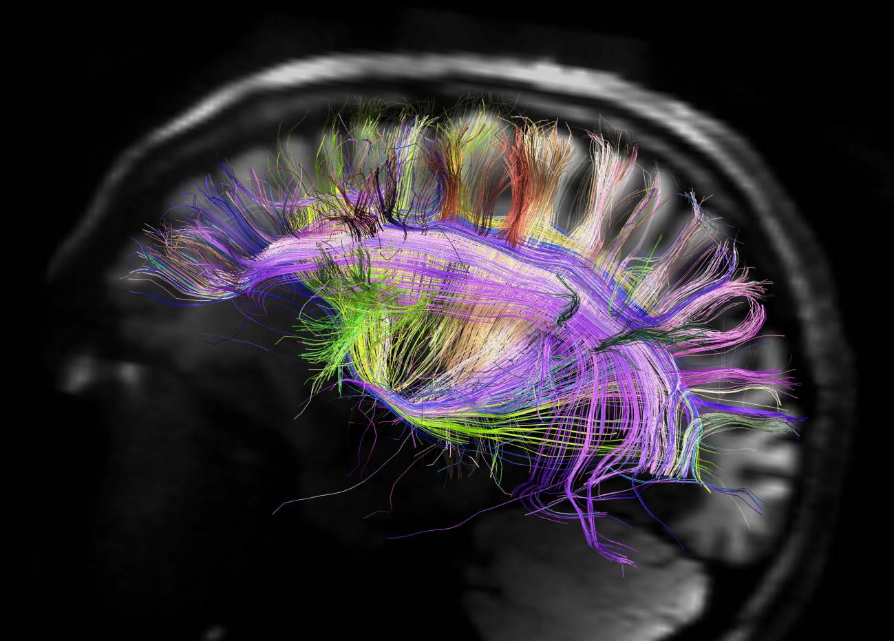 La organización neuronal  traza caminos en forma de rejilla. Imagen: MGH UCLA Human Connectome Project_science  