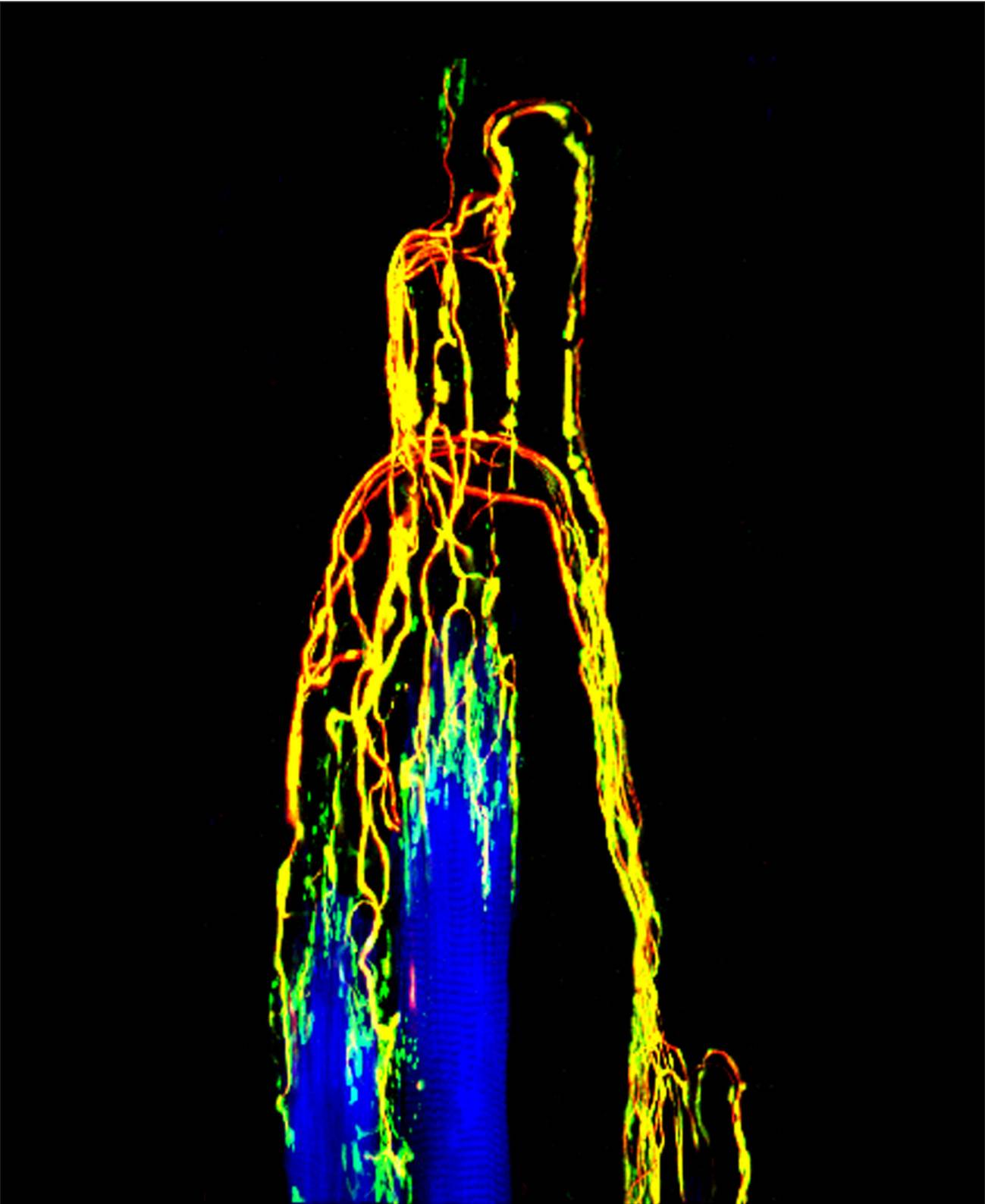 Extremo final de fibras nerviosas (marcadas de amarillo y rojo) que forman un capuchón (amarillo y verde) que recubre ciertas fibras musculares (marcadas de azul). / Zimmerman et al.